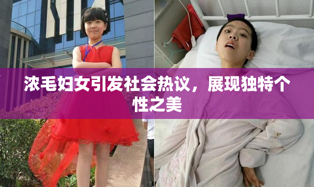 浓毛妇女引发社会热议，展现独特个性之美