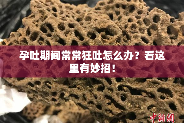 孕吐期间常常狂吐怎么办？看这里有妙招！