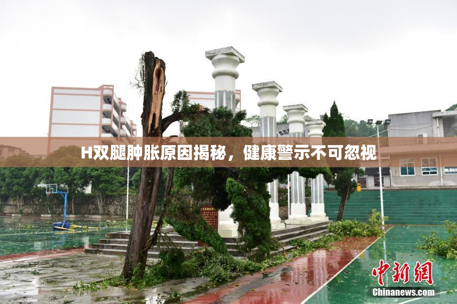 H双腿肿胀原因揭秘，健康警示不可忽视