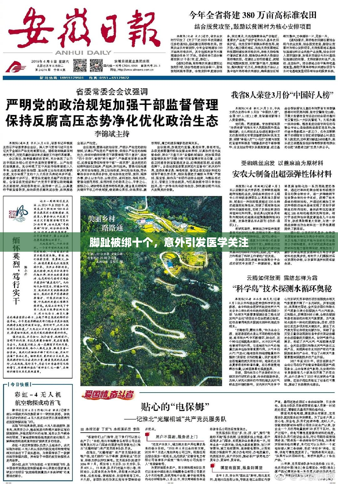 脚趾被绑十个，意外引发医学关注