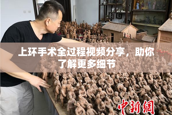 上环手术全过程视频分享，助你了解更多细节