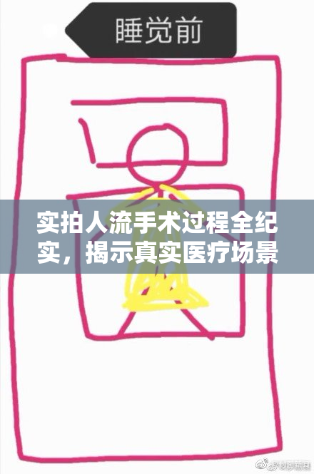 实拍人流手术过程全纪实，揭示真实医疗场景