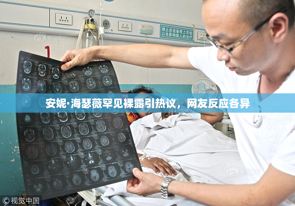 安妮·海瑟薇罕见裸露引热议，网友反应各异