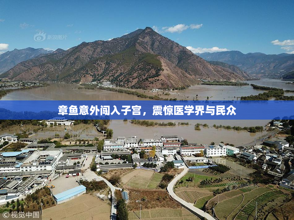 章鱼意外闯入子宫，震惊医学界与民众