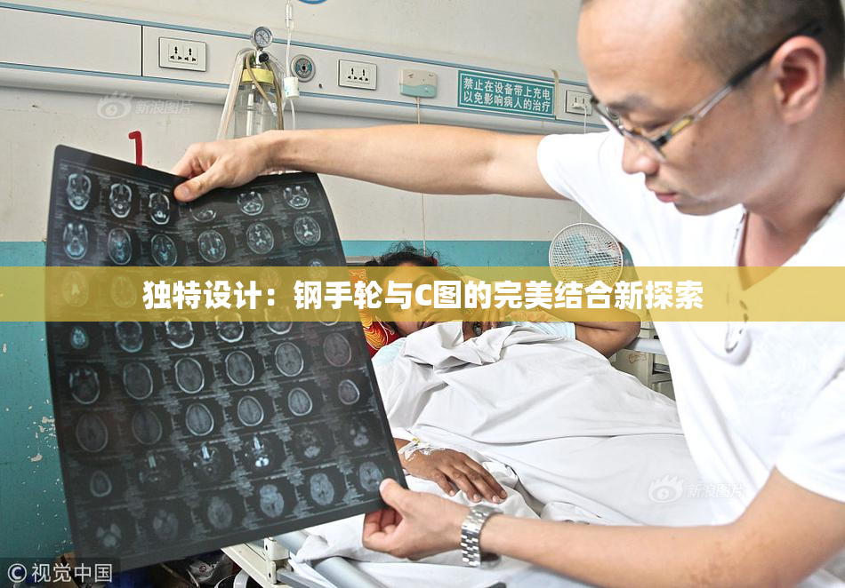 独特设计：钢手轮与C图的完美结合新探索