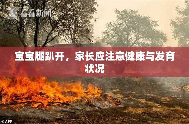 宝宝腿趴开，家长应注意健康与发育状况