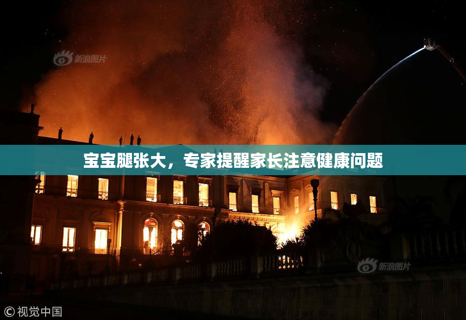 宝宝腿张大，专家提醒家长注意健康问题