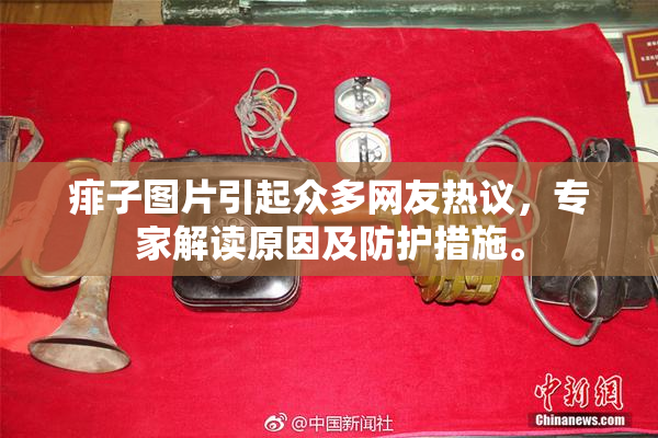痱子图片引起众多网友热议，专家解读原因及防护措施。