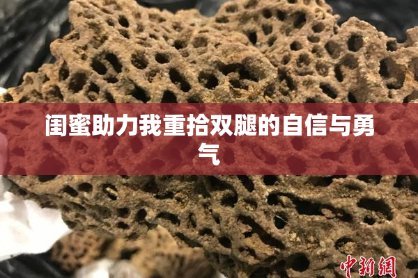 闺蜜助力我重拾双腿的自信与勇气