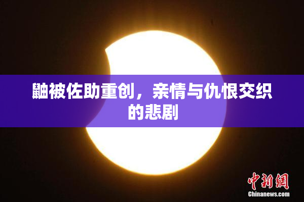 鼬被佐助重创，亲情与仇恨交织的悲剧