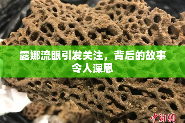 露娜流眼引发关注，背后的故事令人深思