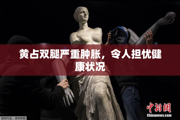 黄占双腿严重肿胀，令人担忧健康状况