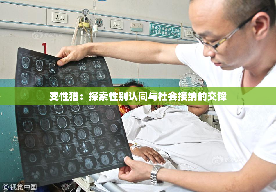 变性猎：探索性别认同与社会接纳的交锋