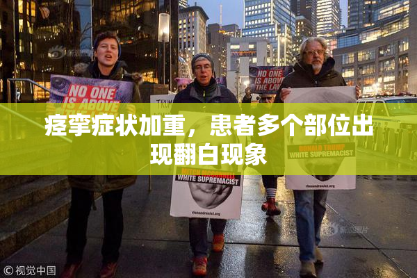 痉挛症状加重，患者多个部位出现翻白现象